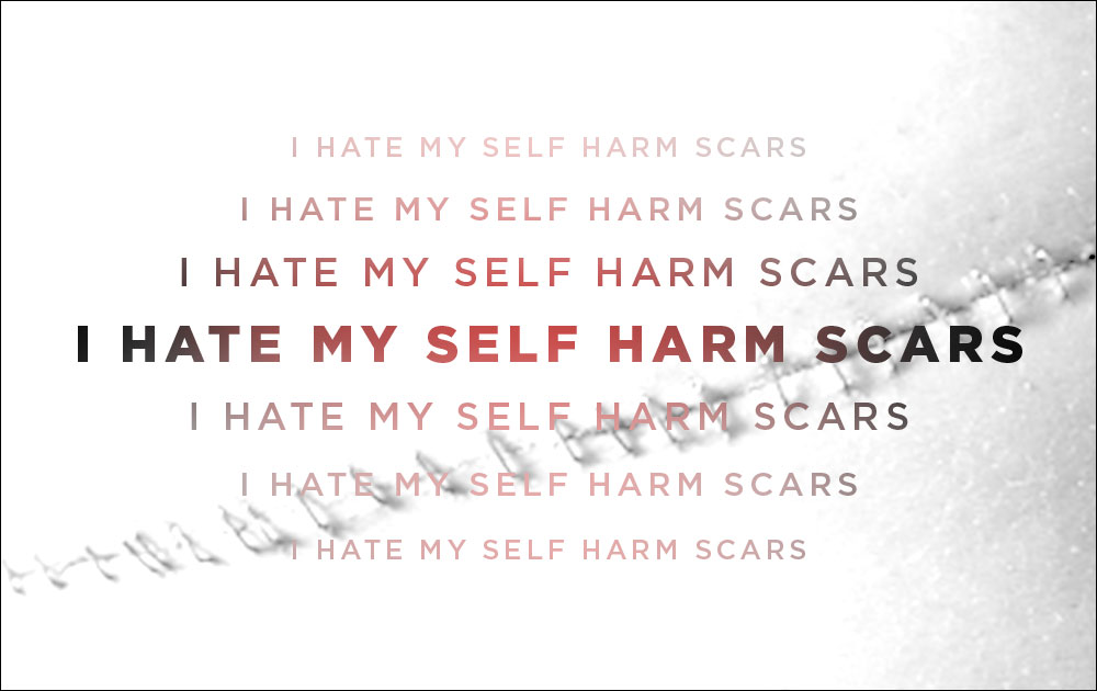 I Hate My Self Harm Scars